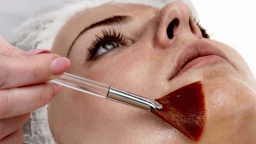 Пилинг Джесснера в Алматы | Клиника Restetica